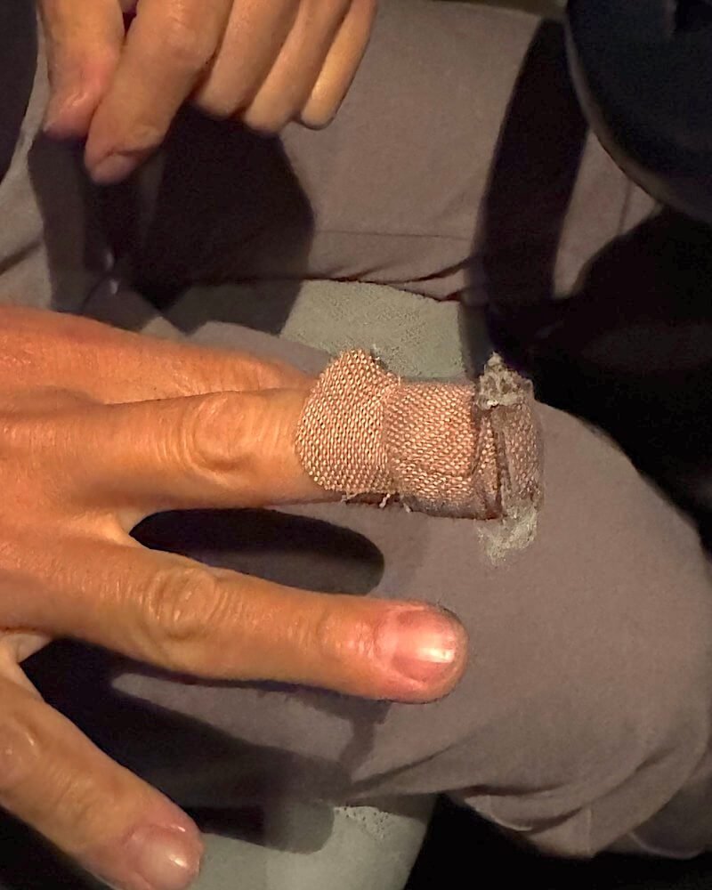 Hand with a finger wrapped in beige gauze bandage after setting up a camping tent