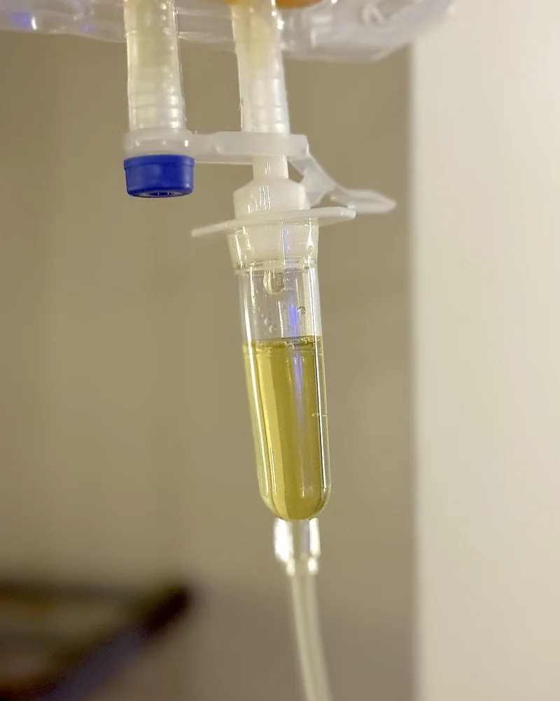 NAD IV Therapy: What My First 1,000 mg Drip Was Like (And the Week After) Close-up of the IV drip chamber filled with yellow fluid, set to drip slowly