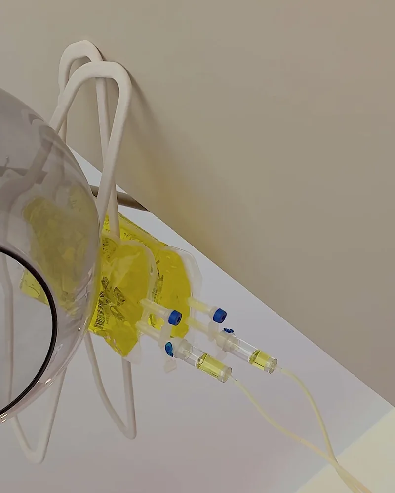 What Is in an IV Drip? Every Ingredient in My At-Home IV Bag (and Why It Turned Yellow) Close up of a bright yellow vitamin IV bag hanging from a lamp