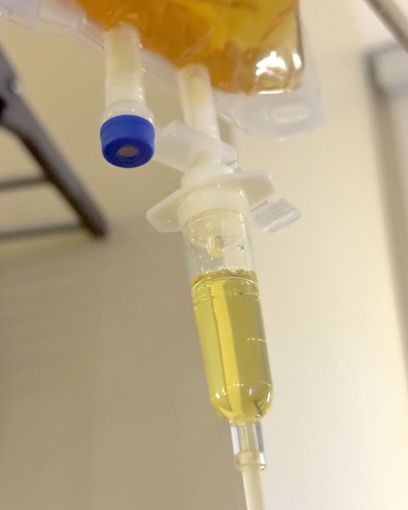 How Long Does an IV Drip Take? My 90-Minute vs 6-Hour Drips Close up of the clear IV drip chamber under the bag, where you can watch each drop fall