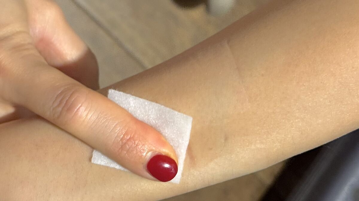 How Long Does an IV Drip Take? My 90-Minute vs 6-Hour Drips Pressing a cotton pad on my arm right after the IV needle came out